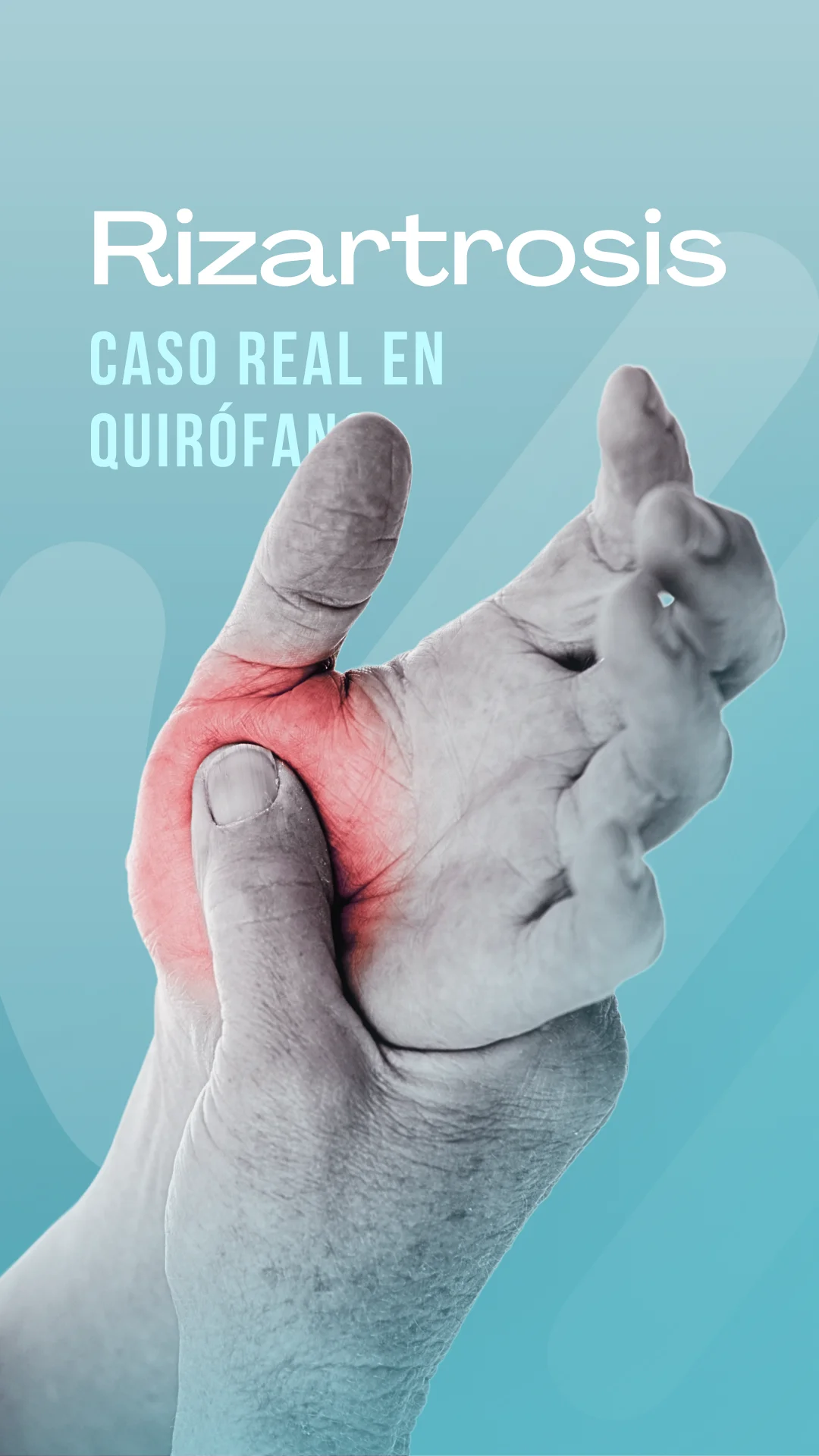 Dr. Martin Iglesias - Traumatólogo